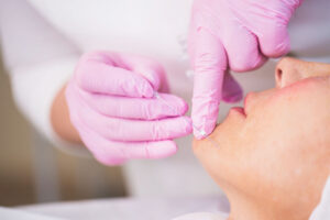 عوارض نخ کلاژن و نقش مهارت پزشک؛ چگونه ریسک‌ها را به حداقل برسانیم